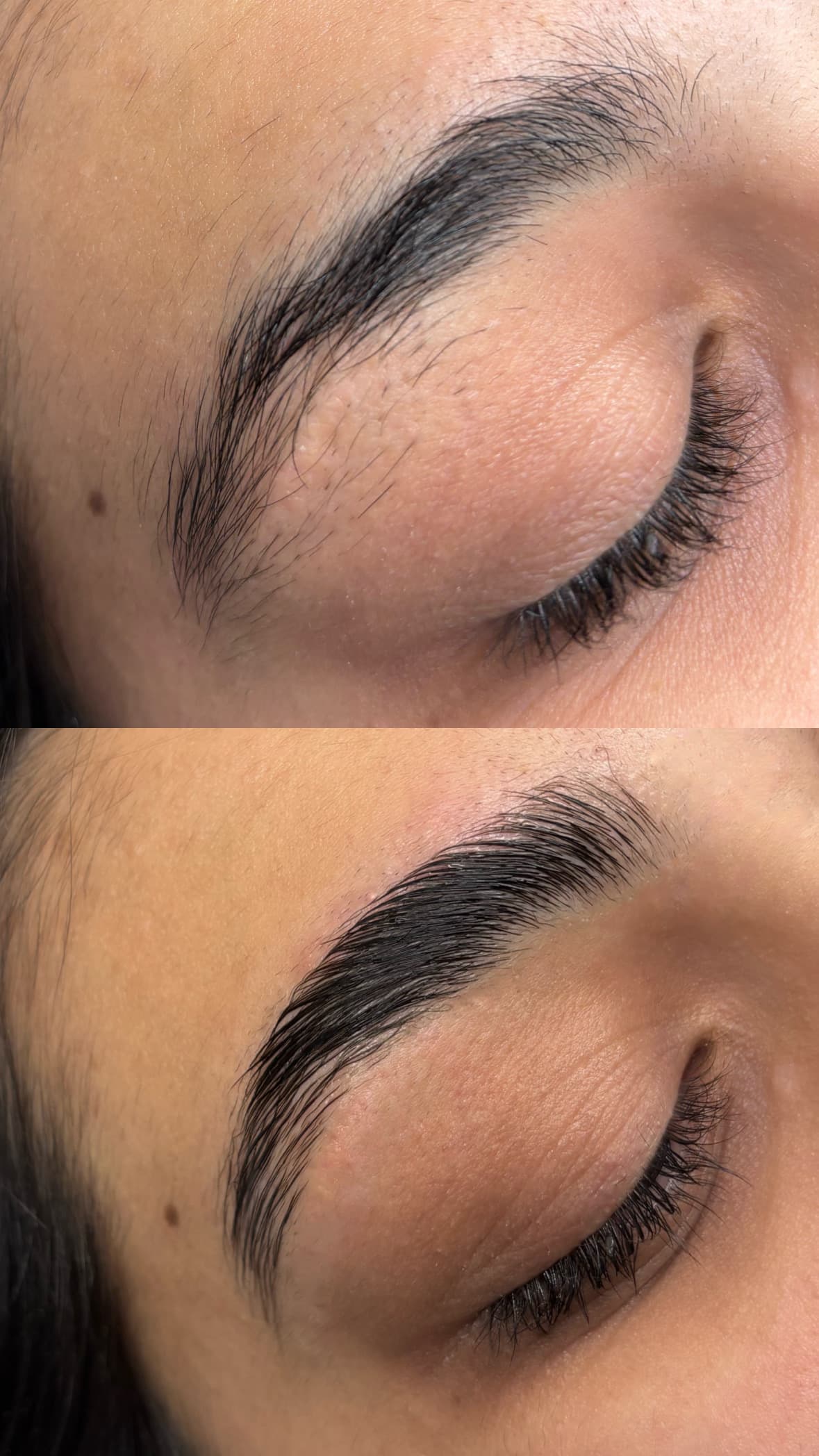 Augenpaket — Bild 1